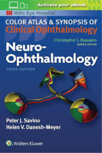 Neuro-ophthalmology